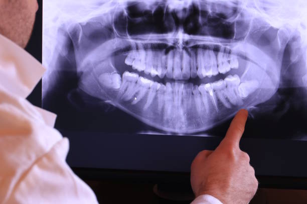 Best Emergency Treatment for Toothache in Vandalia, IL