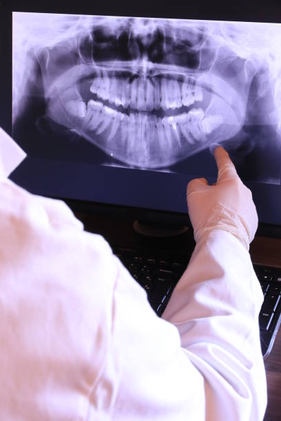 Best Emergency Tooth Extraction in Vandalia, IL