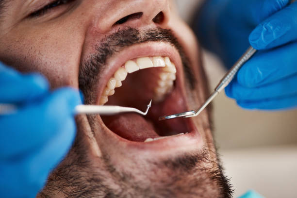 Best Emergency Broken Tooth Repair in Vandalia, IL