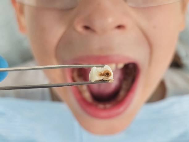 Best Pediatric Emergency Dentist in Vandalia, IL